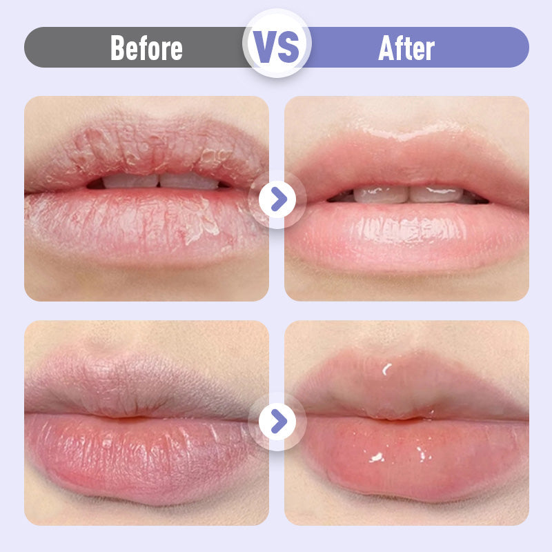 ⏳Spécial à durée limitée⏰Sérum Hydratant Repulpant et Anti-Rides pour les Lèvres💋