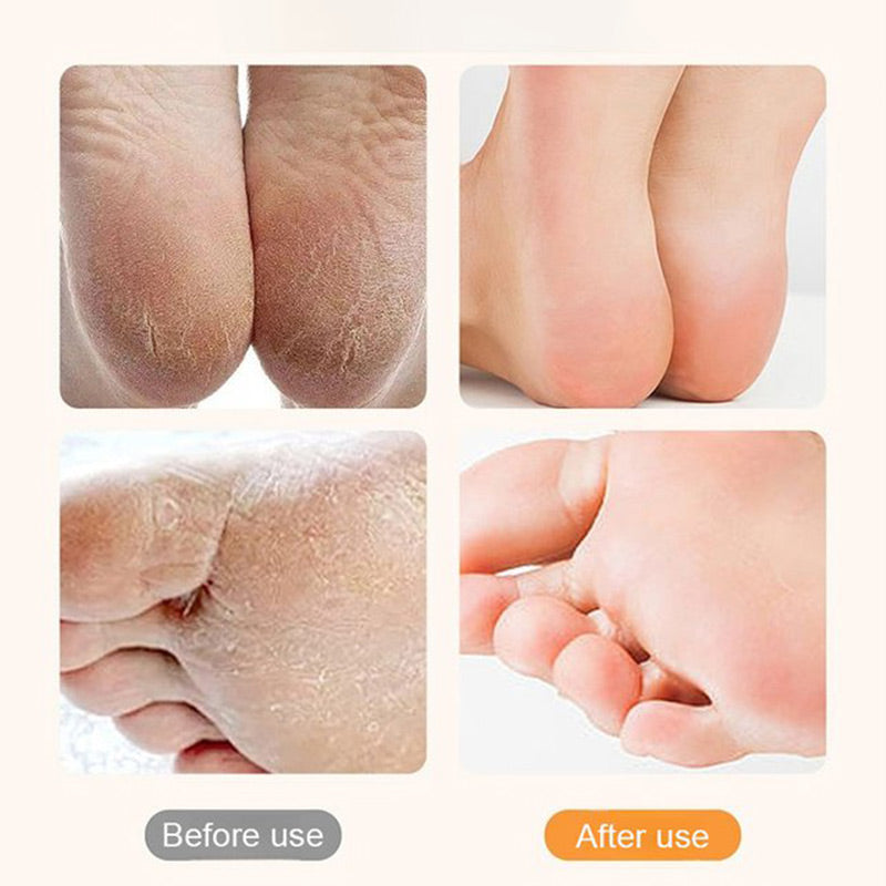 🔋🦶Exfoliateur électrique rechargeable pour les pieds🌟 Exfolie en douceur, lisse les pieds, indispensable pour les pédicures à domicile !
