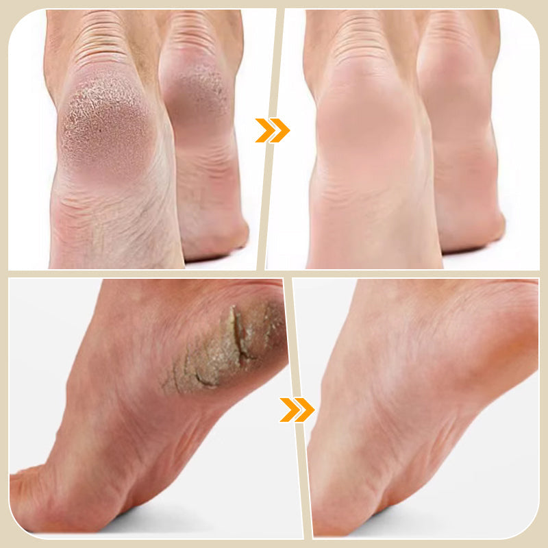 Fichier de pied manuel pour peau morte & Callus