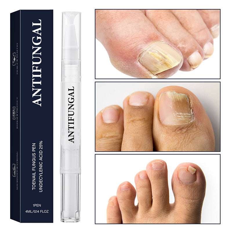 ✨Nouveautés🔥Stylo de traitement contre les champignons des ongles des pieds pour les ongles endommagés