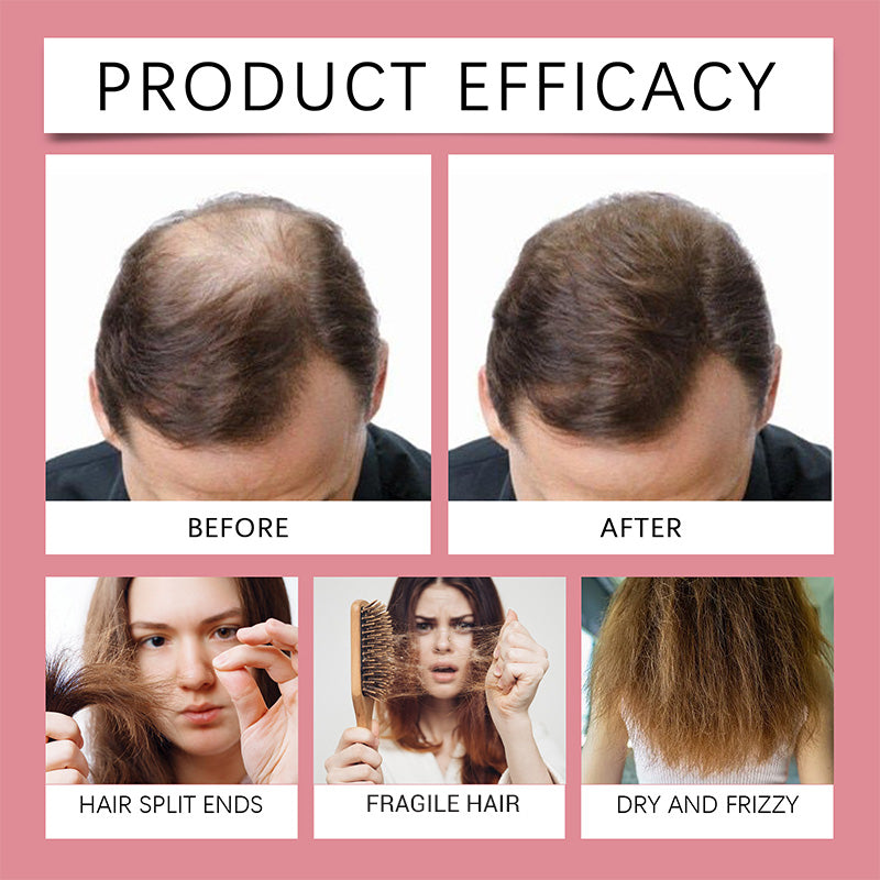 ✨ Spray Capillaire Nourrissant & Fortifiant Doux - Offre Spéciale 2026 : Retrouvez une Chevelure Confiante ! ✨