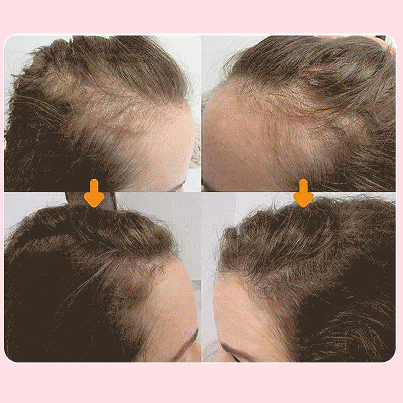 ✨ Spray Capillaire Nourrissant & Fortifiant Doux - Offre Spéciale 2026 : Retrouvez une Chevelure Confiante ! ✨