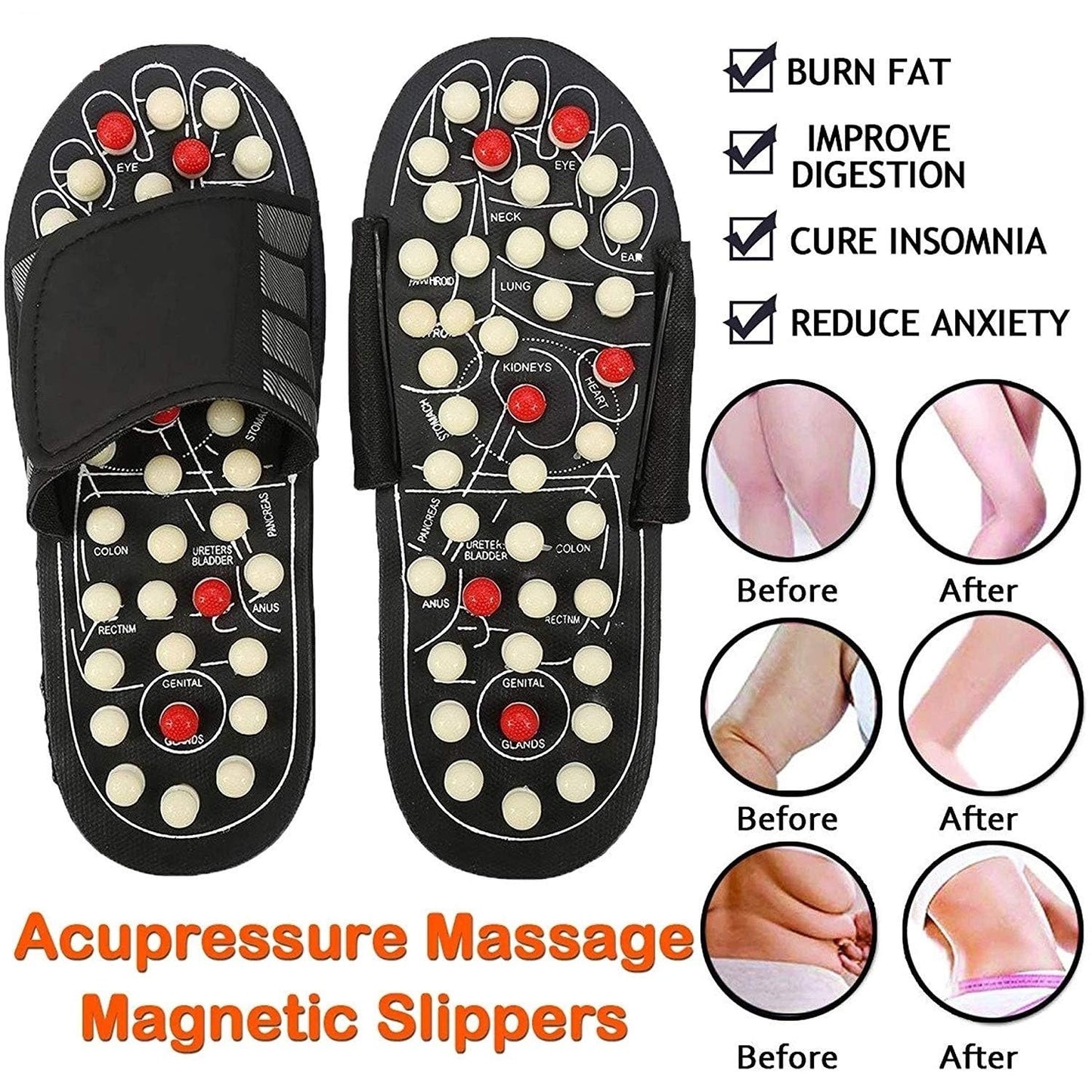 🩴Chaussons d'acupression et de magnétothérapie